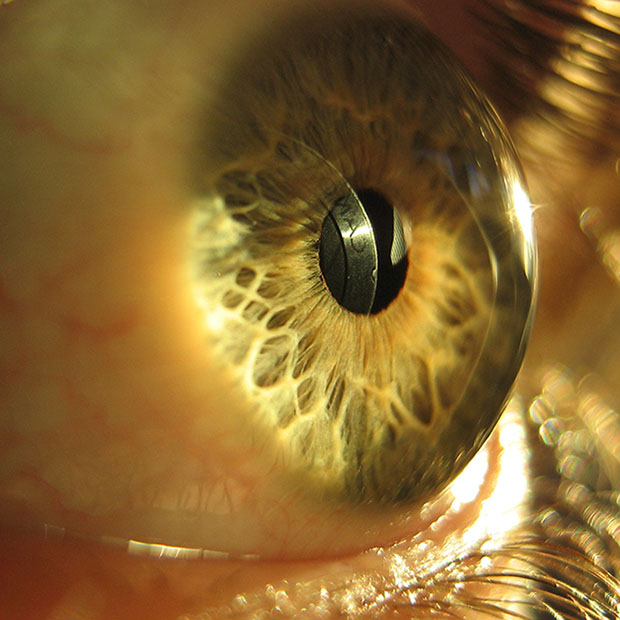 The Mechanics Of Eyesight Manhattan KS Eye Care